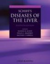 Image of Schiff'S Diseases Of The Liver 11E