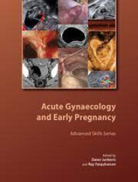 Image of Acute Gynaecology And Early Pregnancy