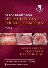 Image of Atlas Berwarna Lesi Mulut Yang Sering Ditemukan