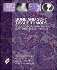 Image of Bone And Soft Tissue Tumors : A Multidisciplinary Review With Case Presentation