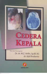 Image of Cedera Kepala : Teori Dan Penanganan