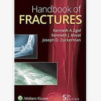 Image of Handbook Of Fractures