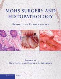 Image of Mohs Surgery And Histopathology