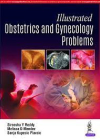 Image of Illustrated Obstetrics And Gynecology Problems