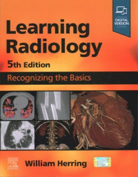 Image of Learning Radiology : Recognizing The Basic
