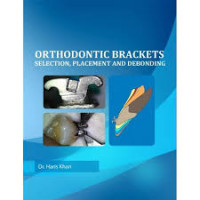 Image of Orthodontic Brackets Selesction, Placement and Debonding