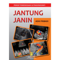 Image of Prinsip Pemeriksaan Ultrasonografi Jantung Janin