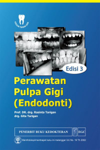 Image of Perawatan Pulpa Gigi *Endodonti)