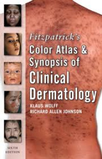 Image of Fitzpatrick's Color Atlas and Synopsis of Clinical Dermatology: Sixth Edition
