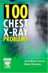Image of 100 Chest X-Ray Problems