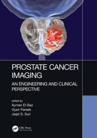 Image of Prostate Cancer Imaging